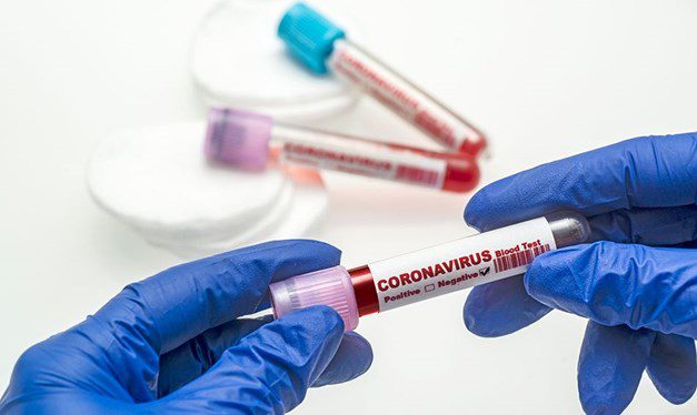 18 Ekim 2020 corona virüs tablosu: 72 can kaybı, bin 815 yeni hasta sayısı