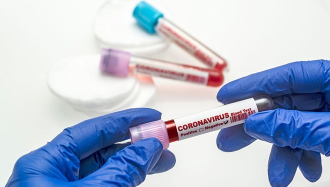 15 Nisan 2021 corona virüs tablosu:  297 can kaybı, 61 bin 400 yeni vaka